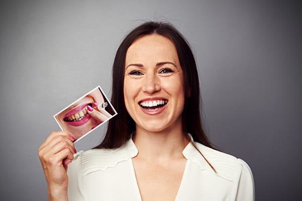 tobacco-use-dental-zen